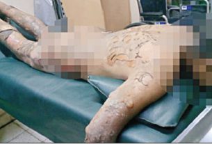 Un hombre atenta contra su propia vida por amor no correspondido