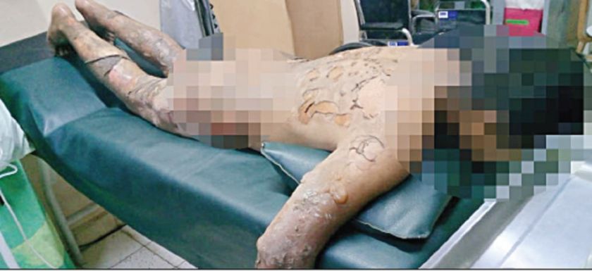 Un hombre atenta contra su propia vida por amor no correspondido